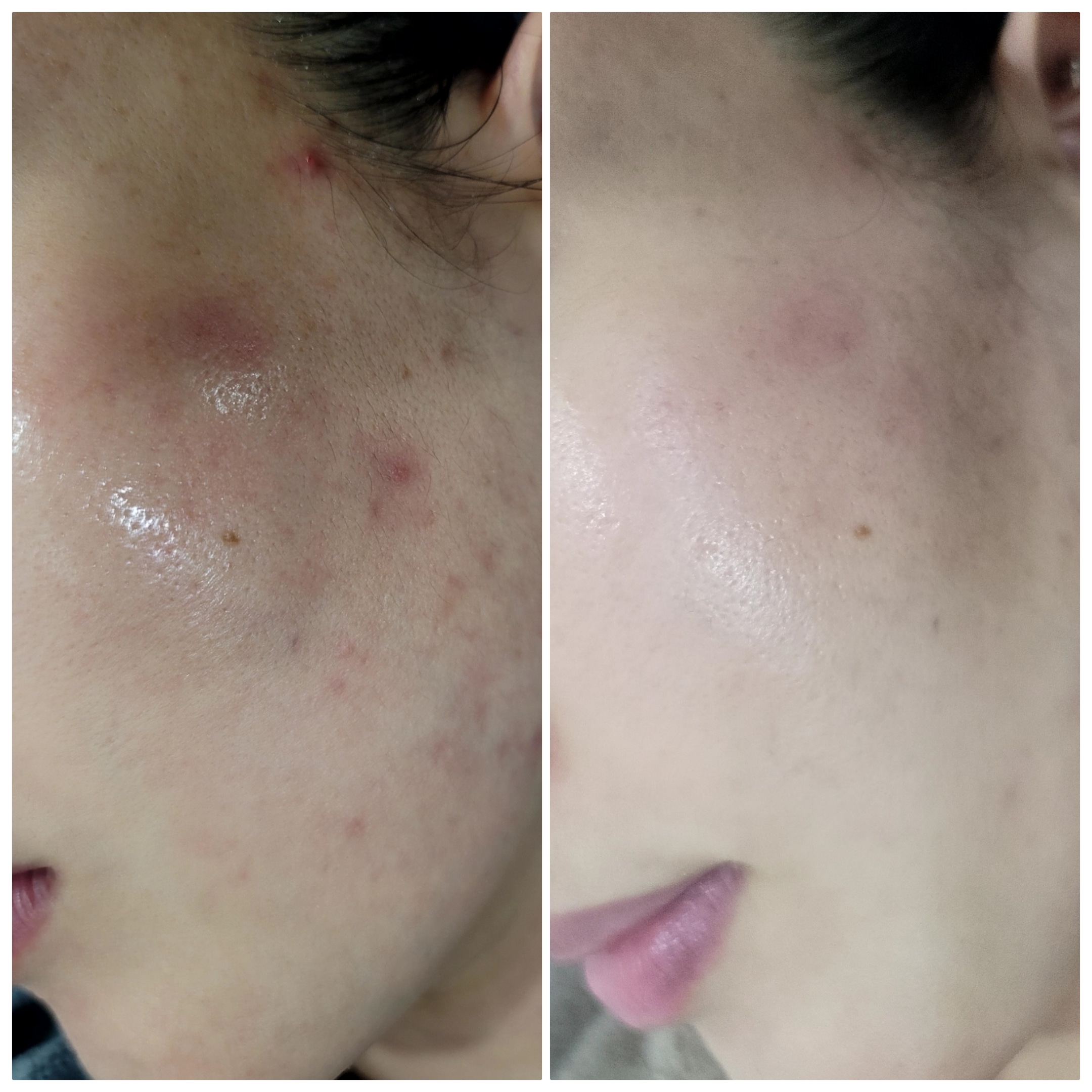 /user/k/kbeauty/editor/2301/3aefeebb27b2e2f33289a753bbf72702_1674017200_263.jpg 이미지크게보기