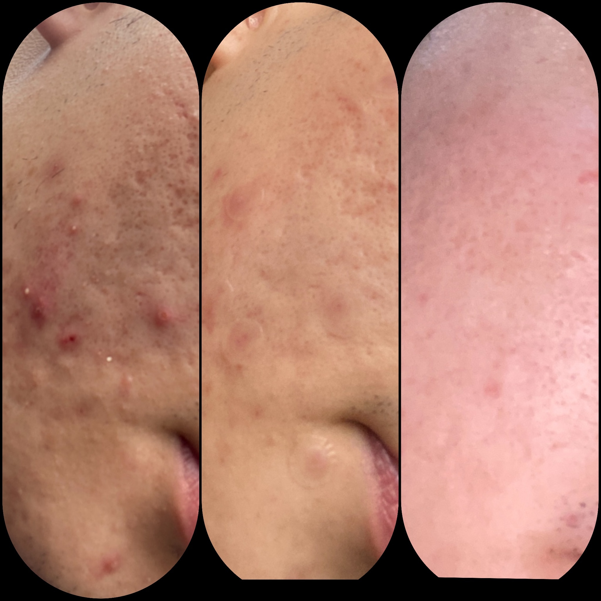 /user/k/kbeauty/editor/2301/3aefeebb27b2e2f33289a753bbf72702_1674017545_8757.jpg 이미지크게보기